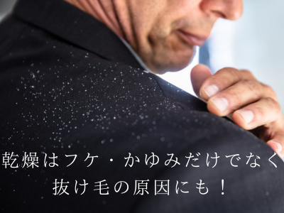 シャンプー フケ かゆみ