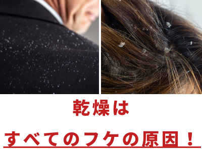 シャンプー 保湿成分