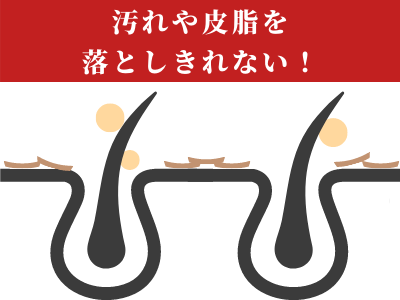 シャンプー 洗浄力